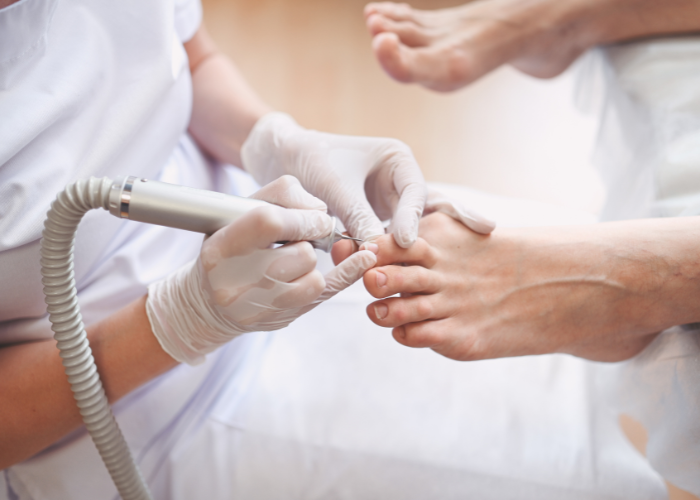 Tratamiento clínico especializado para hongos y pie diabético